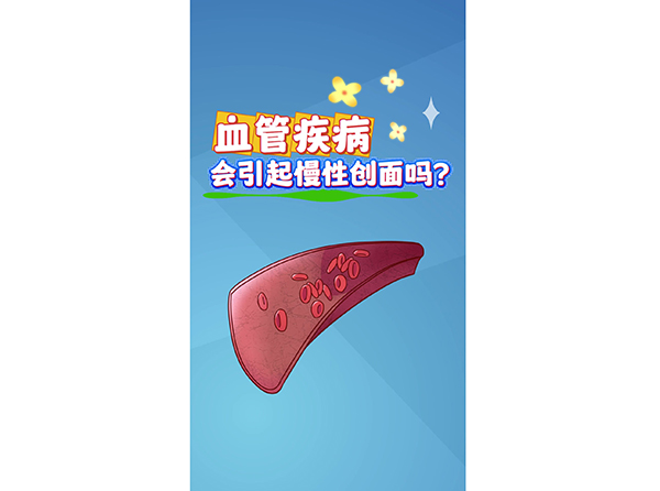 血管疾病会引起慢性创面吗？